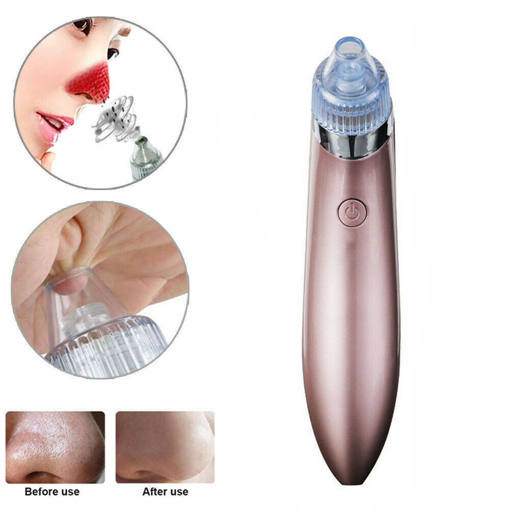 Electric Blackhead Vacuum Pore Cleaner Acne Pimple Remover Strong Suct