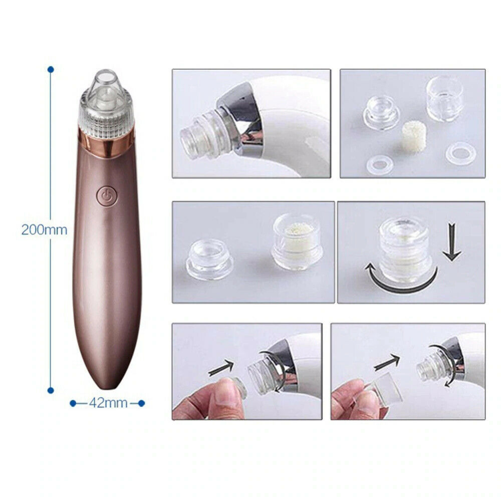 Electric Blackhead Vacuum Pore Cleaner Acne Pimple Remover Strong Suct