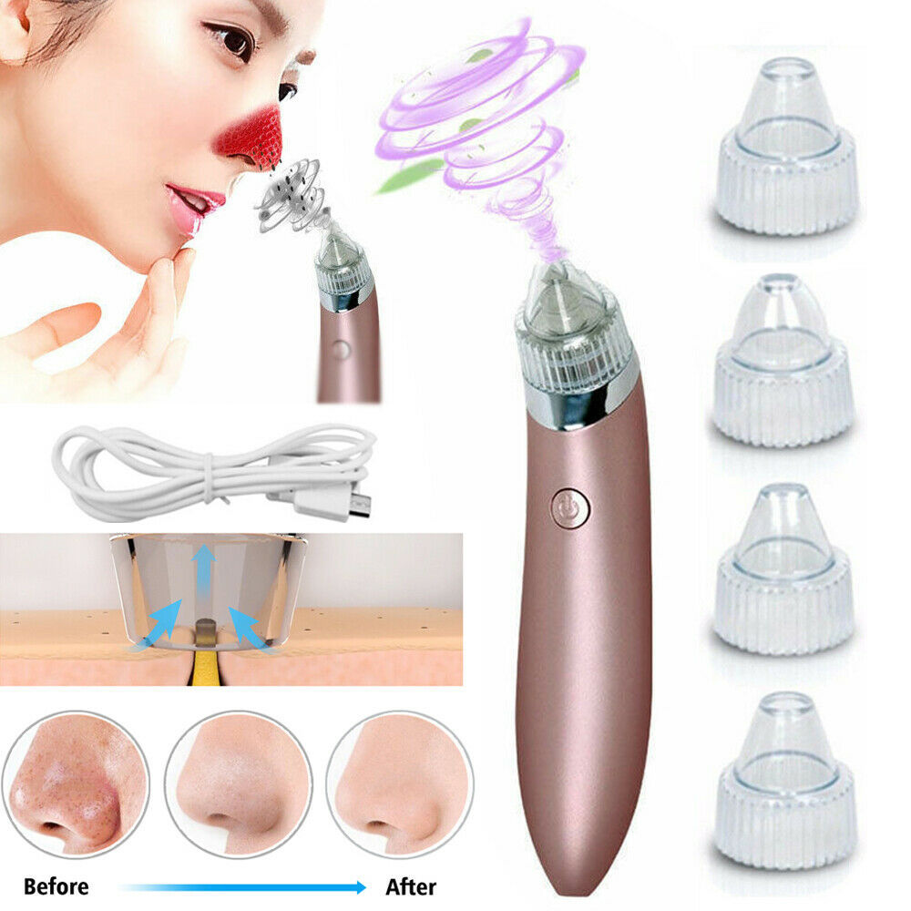 Electric Blackhead Vacuum Pore Cleaner Acne Pimple Remover Strong Suct